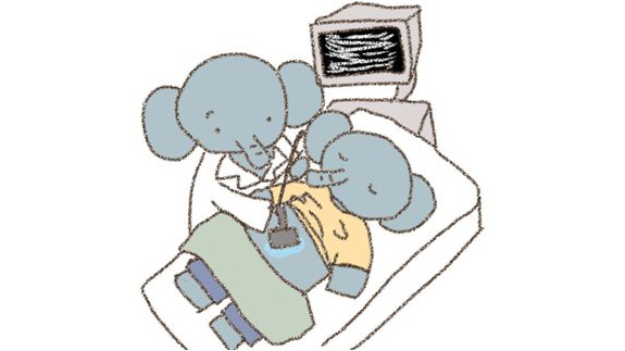腹部エコー（超音波）検査